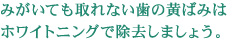 みがいても取れない歯の黄ばみはホワイトニングで除去しましょう。