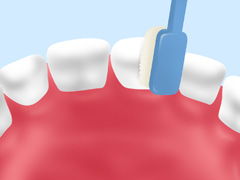 歯磨き指導（TBI）